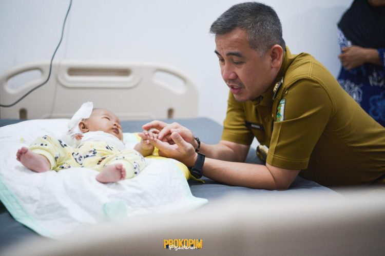 Bayi Usia 4 Bulan Tersiram Air Panas Dikunjungi Bupati Pesawaran