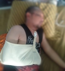 Akibat Jalan Rusak dan Berlobang, Seorang Pemotor Kecelakaan Tunggal Hingga Patah Tulang