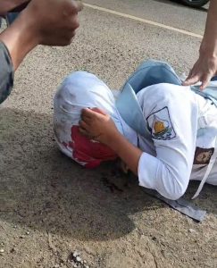 Akibat Jalan Rusak dan Berlubang, Siswi SMAN 1 Cilograng Diduga Tersungkur Laka Tunggal di Jalan Nasional 