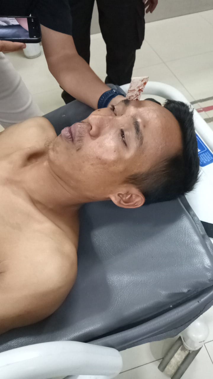 Brutal! Seorang Warga Babak Belur Dikeroyok oleh Sekelompok Orang Tak Dikenal di RSUD Malingping
