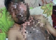 Dua Pekan Kritis Usai Tersengat Listrik, Warga Gununggede Lebak Tutup Usia